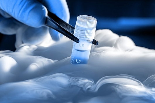 Je přeprava zmrazených buněk pro IVF bezpečná?