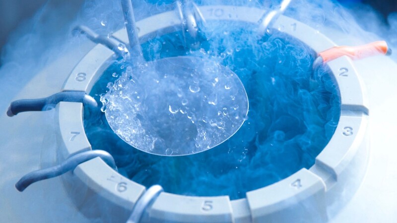 cryo